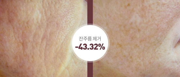 전후사진